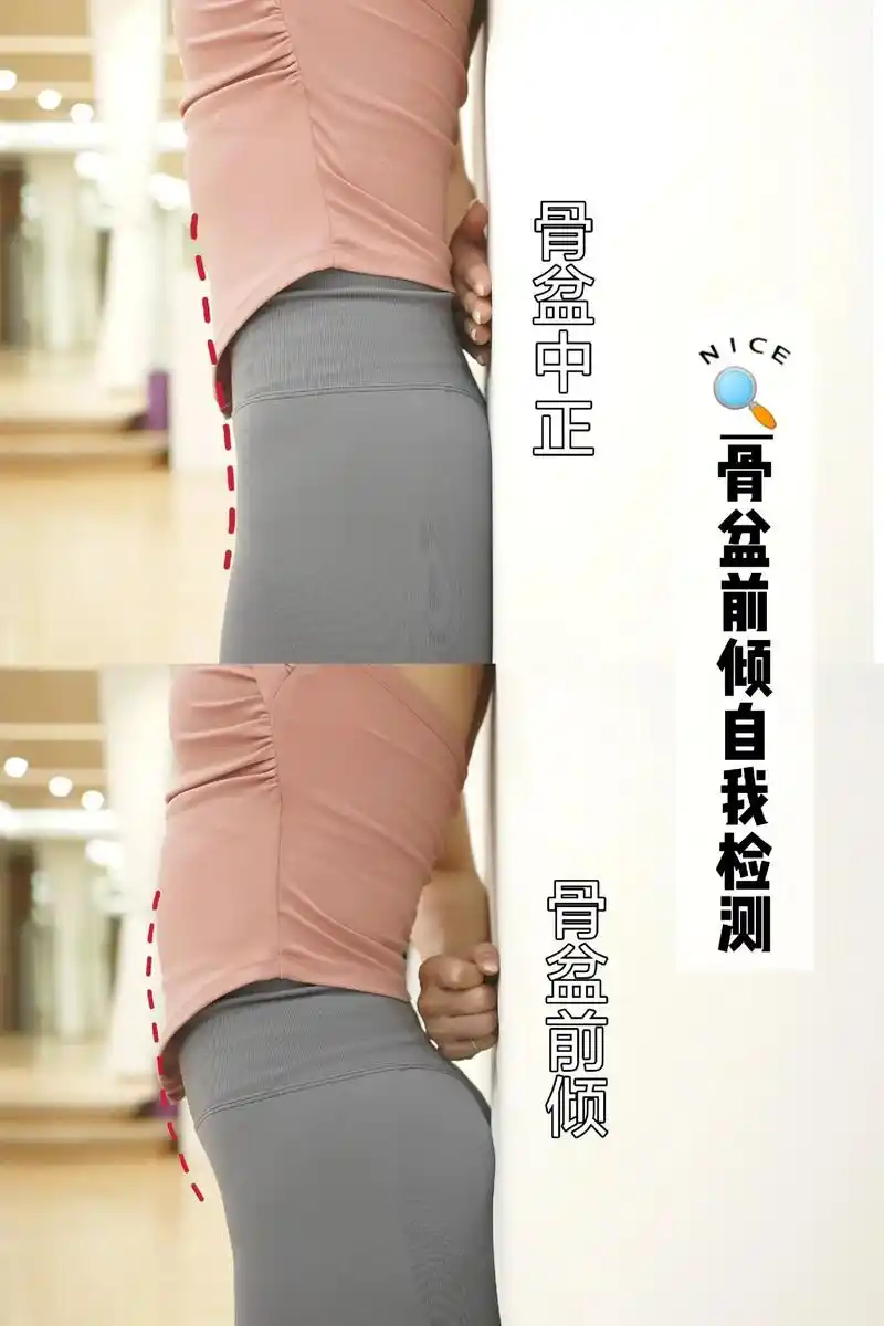 体态调整|骨盆前倾自我检测77调整方法 .