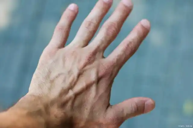 手背青筋现象:女性朋友们的健康与命运解读