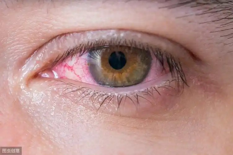 宝宝睡觉醒来突然眼睛肿,妈妈焦虑,医生教你3点排查沉着应对