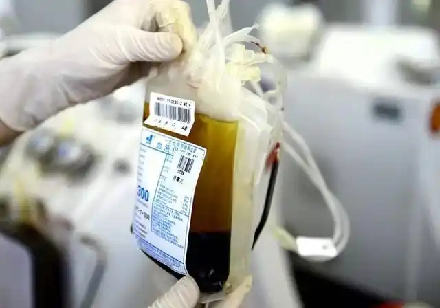 离心后血液分离成不同成分 (黄色的是血浆,红色是红细胞)