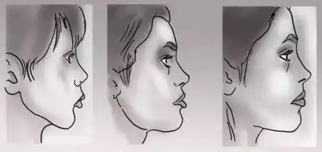 这样喂孩子,小女孩竟然变成"瘪嘴老太".