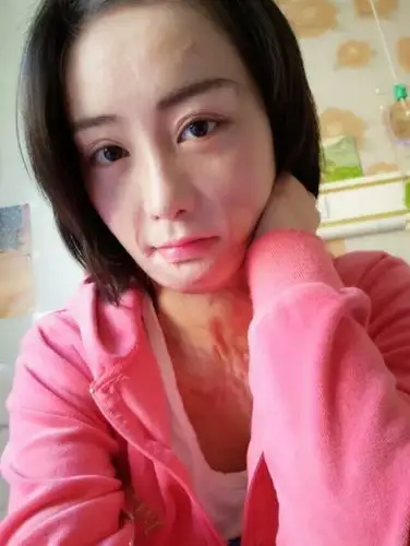 我挺同情这个女孩儿的,获赔180万,纳闷的一点是