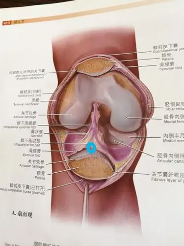 再论膝关节(膑下脂肪垫劳损)
