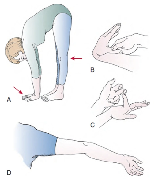 分别是双肘伸直,双腕屈曲,双小指背伸,膝关节伸直和身体屈曲活动度