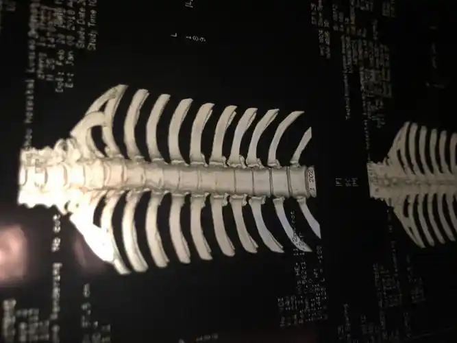 求助:一次正骨意外两年来痛苦不堪