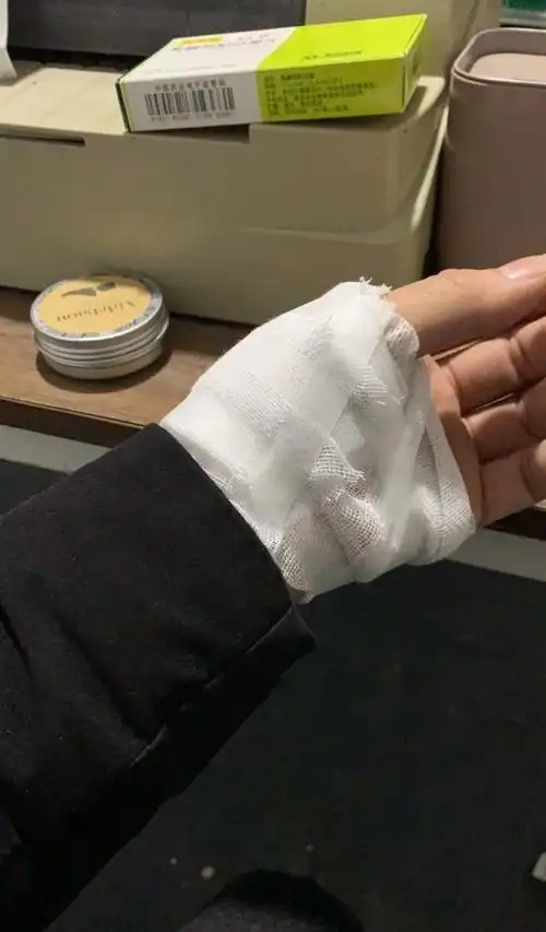 diy路亚手把的代价缝了8针