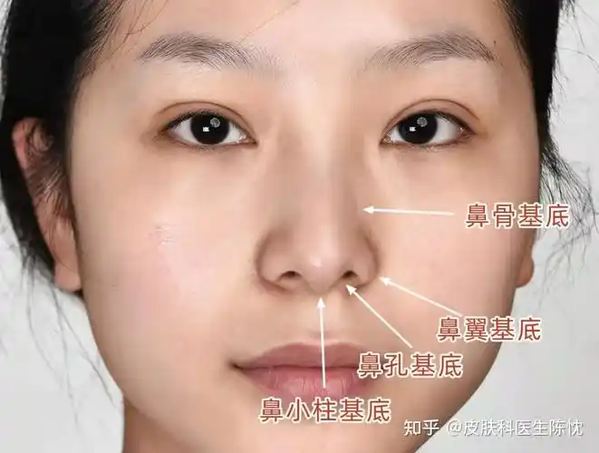 鼻基底凹陷的自测方法