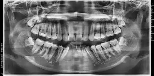 可以帮忙看看我的牙片吗