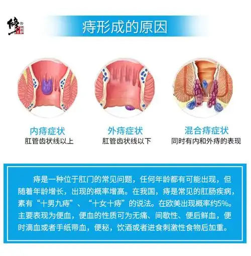 2盒修正百草屁舒抑菌乳膏内痔外痔肉球痔疮膏消痔疮凝胶20g/支