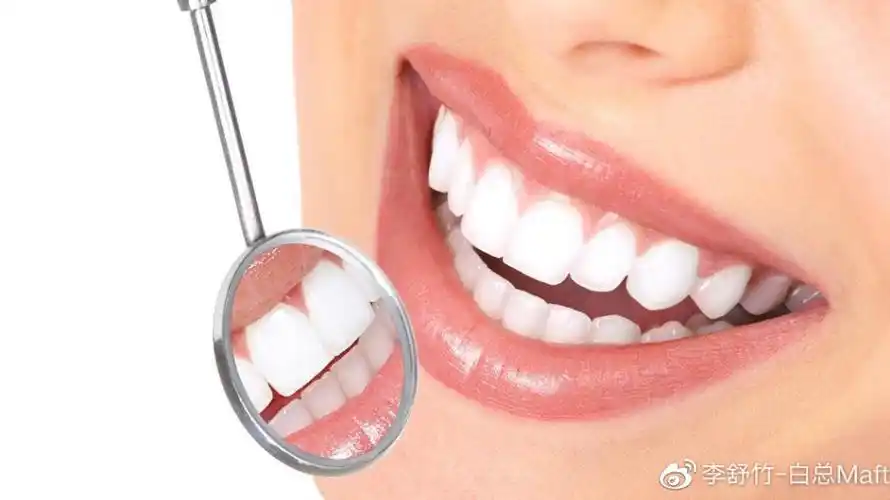 二氧化皓全瓷牙能还你美观整洁的牙齿吗?价格又如何?