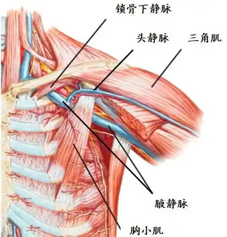 腋静脉是锁骨下静脉的延续,较粗大,在锁骨外,位于胸廓外,是穿刺的较佳