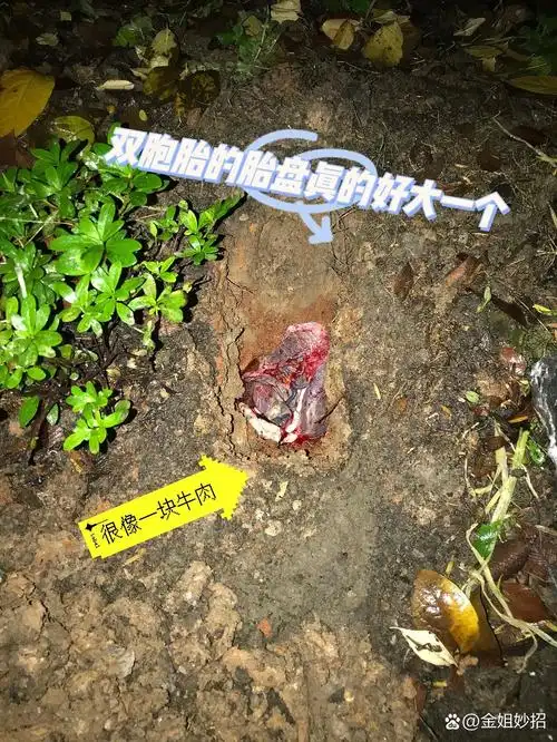 宝宝的胎盘都怎么处理的?