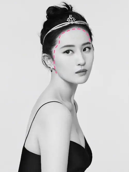 颜值干货|什么样的发际线才算好看