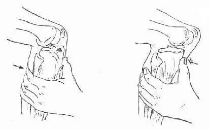 图3-141 抽屉试验