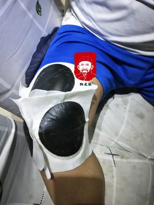 髌骨半脱位症状贴膏药狗皮张好用吗-健康讲堂-膏药铺|膏药招商加盟|狗