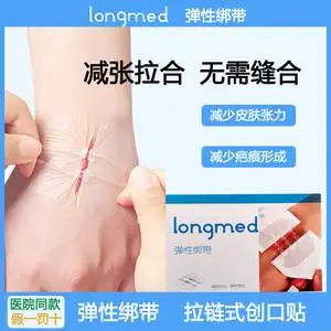 皮肤伤口缝合器疤痕减张器拉链式创口贴儿童一次性免缝针使用医用