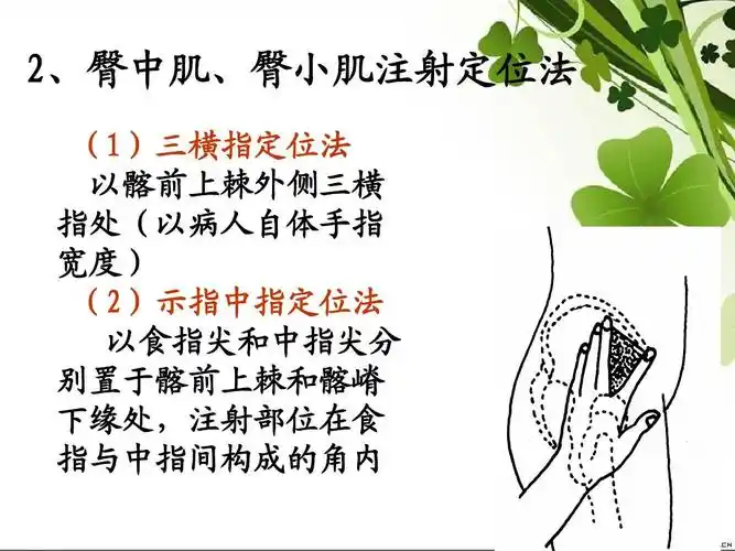 肌内注射法 李瑾炜ppt