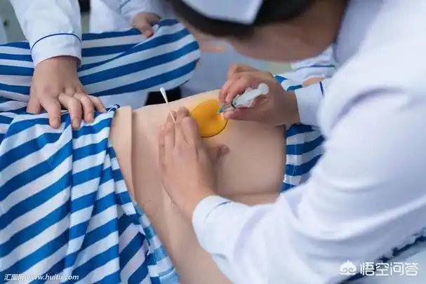 打针为什么选择打在屁股上