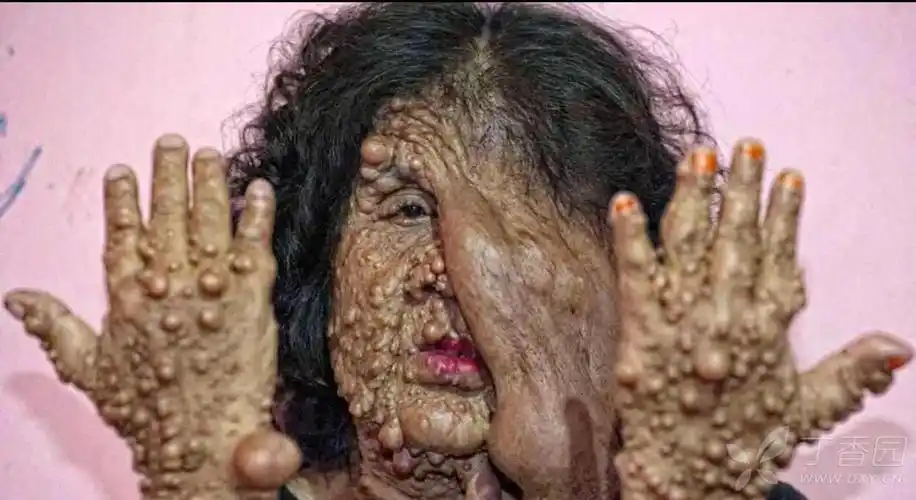 典型:看了能记住一辈子的图片 - 神经科学专业讨论版 - 专业医生社区