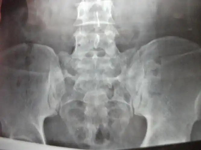 我的坎坷求医路(疑难杂症)我还在路上!