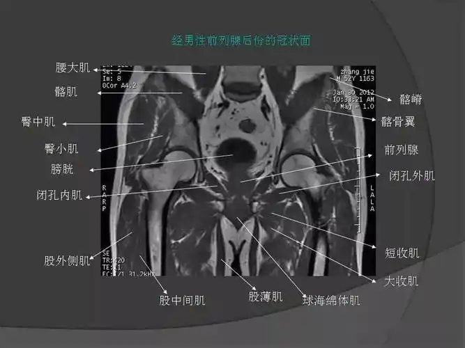 骨盆肌肉解剖mri标识