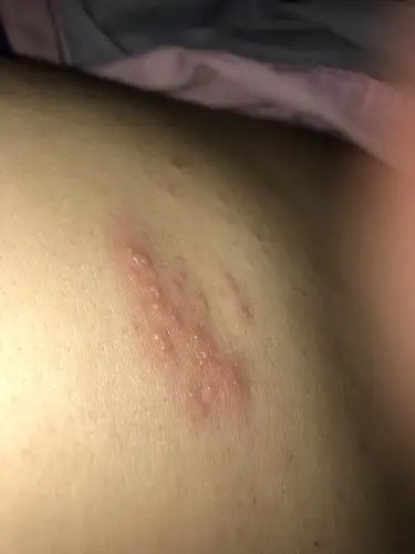 很痒.这是什么?