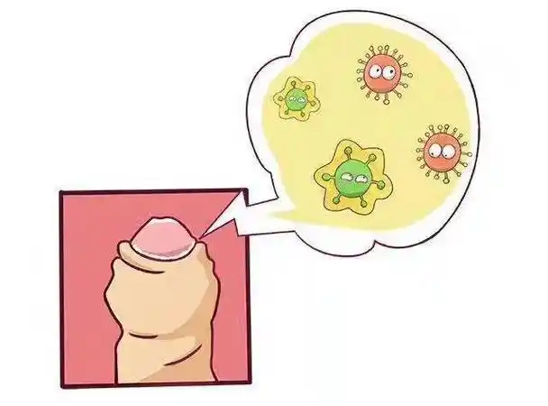丁丁上长小疙瘩,红点,怀疑是出现性病了吗?_包皮_龟头_治疗