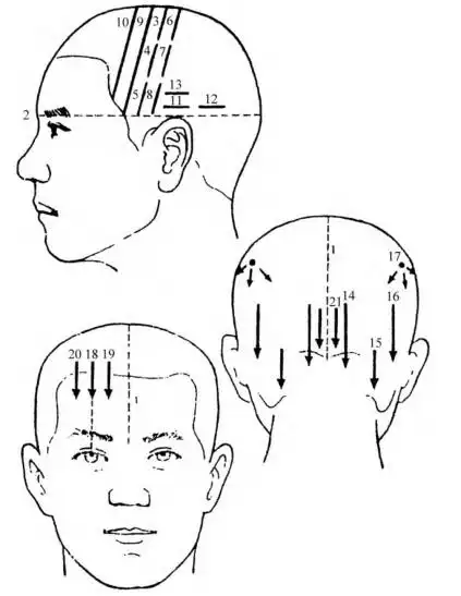 在临床实践中发现,头皮上有与大脑皮质功能基本一致的投射区.
