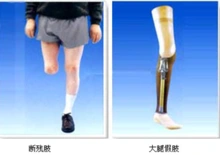 (4)小腿假肢