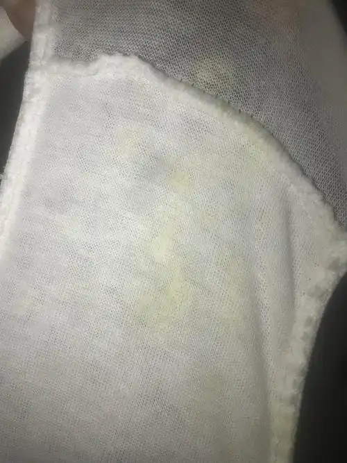 白带腥臭水样黄绿色还痒疫情封闭了小区没法去医院看病怎么办啊有图