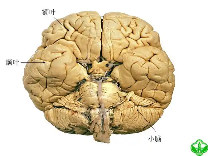 额叶 颞叶 小脑