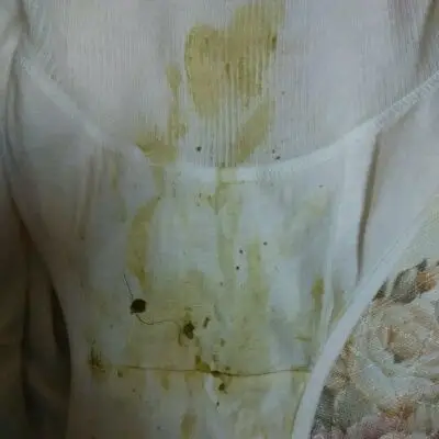 我怀孕七个多月了,这一个多月短裤总是湿湿的,白带总是很黄而且还有味