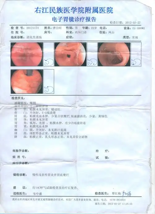 胃病三年了,上腹按压就痛