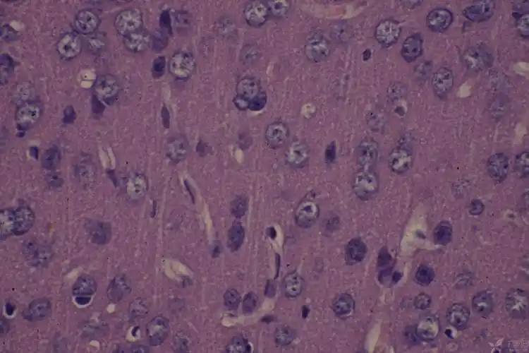 【求助】请大家帮忙看一下he染色的脑组织切片