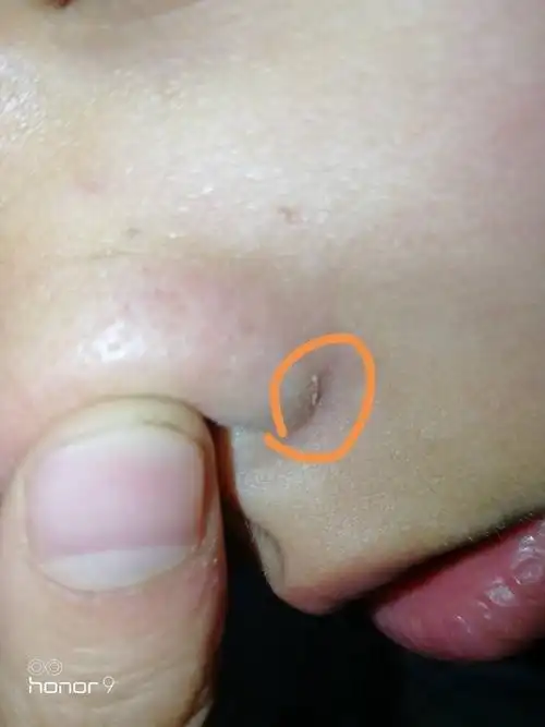 这个鼻子上的白色物体是什么