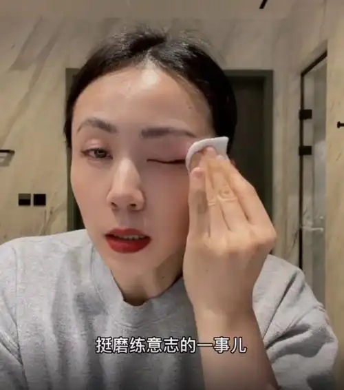 44岁孙莉晒素颜近照卸妆后肤色雪白无瑕疵手部苍老十指显粗糙