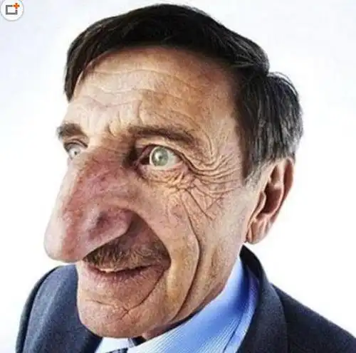 世界上鼻子最大最长的人,8.8cm的鼻子看着像老鹰