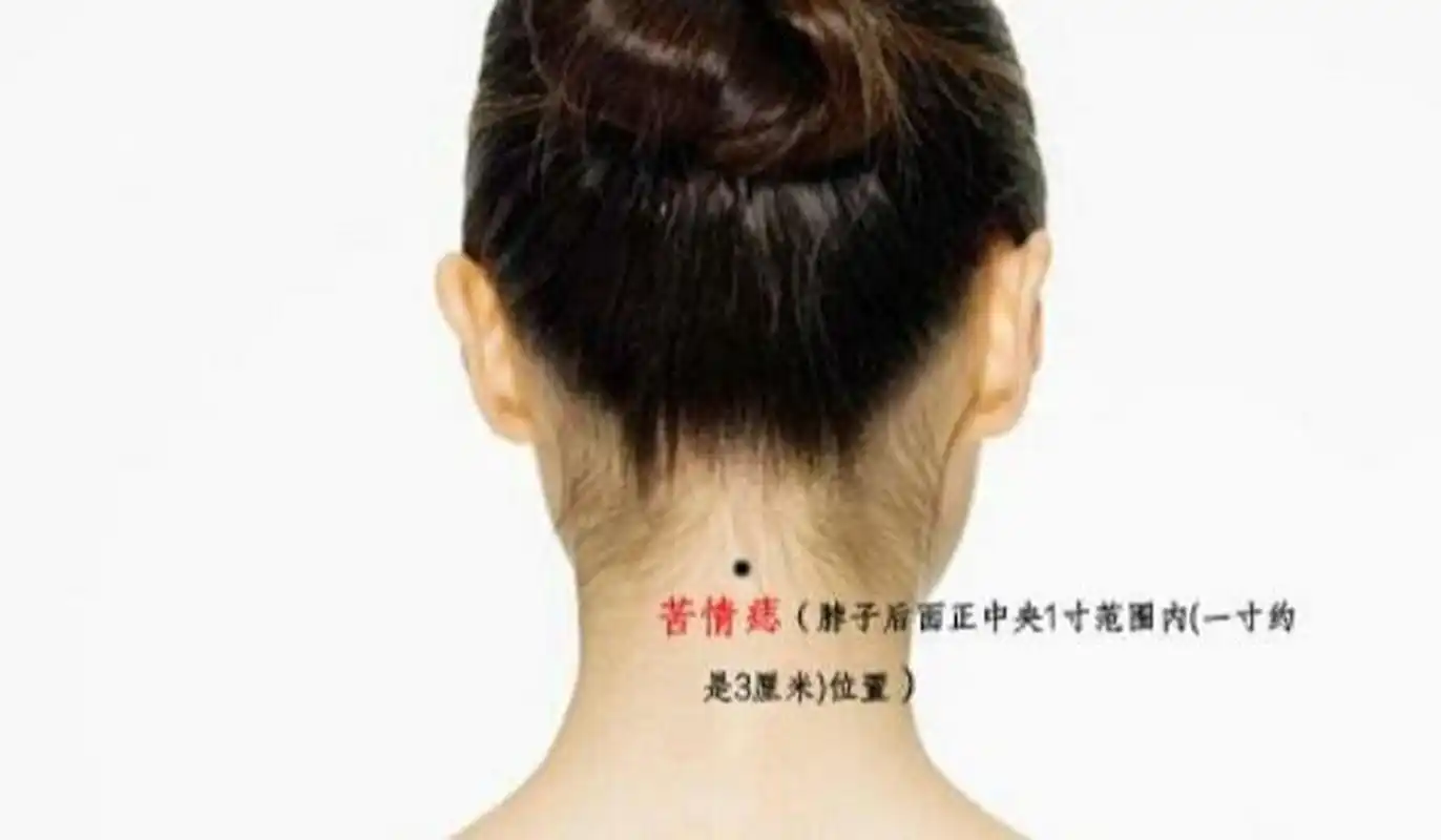 苦情痣长在脖子后面正中的位置,如果不在正中,那么就属于靠山痣.