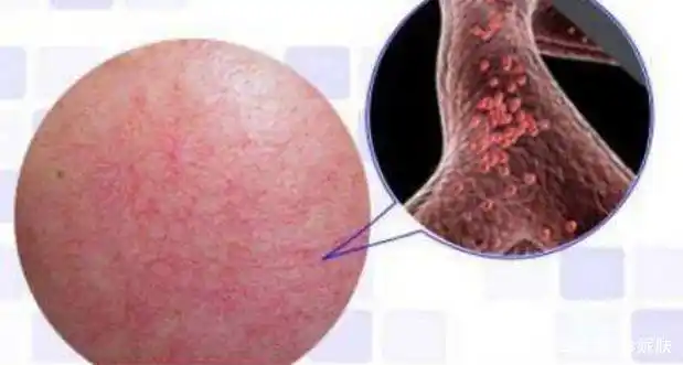 敏感肌春季护理看这里!