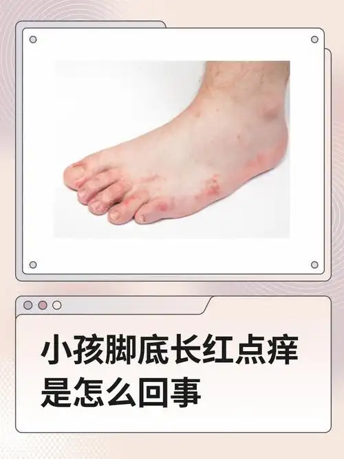 小孩脚底长红点痒是怎么回事