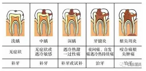 如何判别浅龋中龋深龋的临床表现
