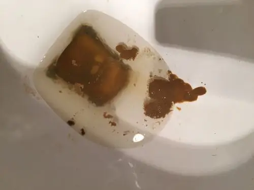 请问这个大便情况看什么科本事肺癌晚期病人谢谢