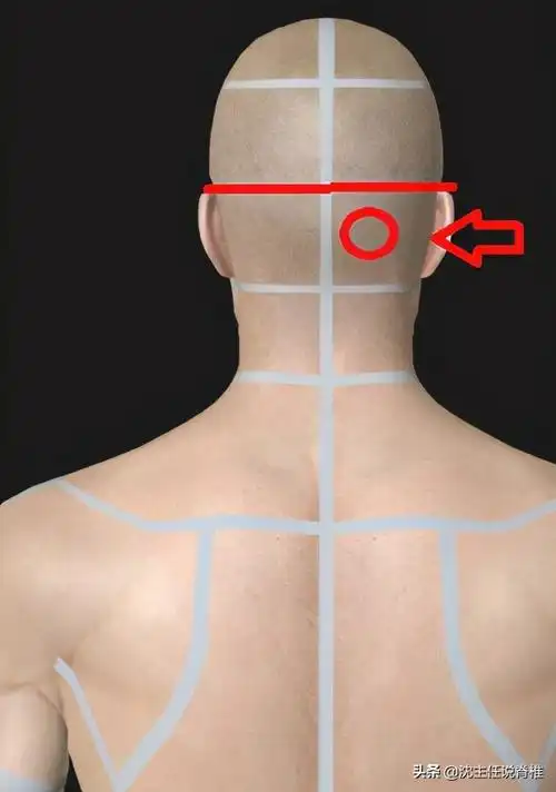 后脑勺阵痛怎么办(右后脑勺一阵一阵痛)