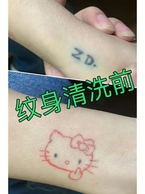 清洗纹身效果对比图