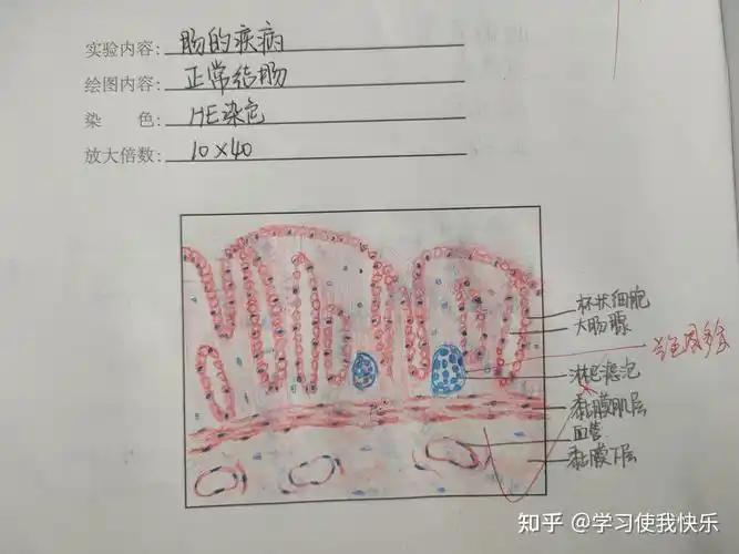 医学病理红蓝铅笔绘图