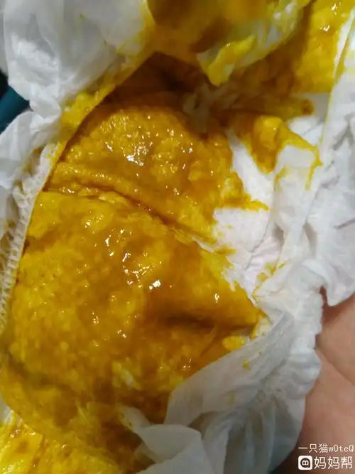 回答图片显示,宝宝这样的大便是不正常的,主要是由消化不良引起的,和