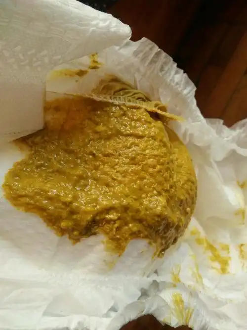 四个多月的宝宝拉这种粑粑正常吗 看起来好像不健康 好担心