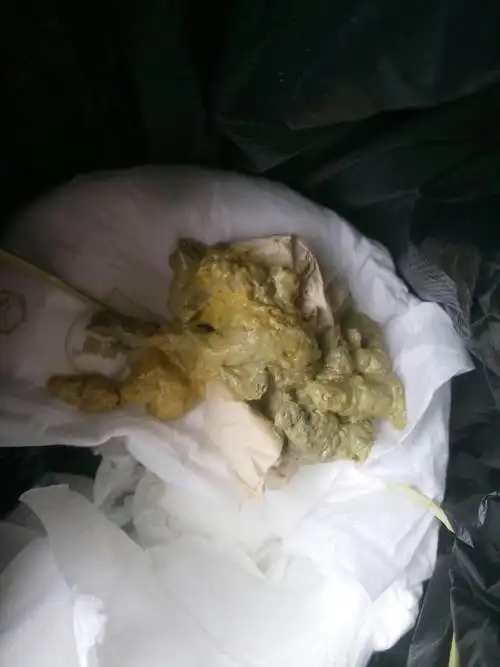 宝宝三个多月,吃奶粉,大便是这种颜色,有时候又是灰色,益生菌一直在吃