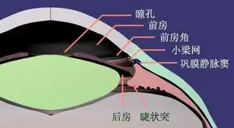 给大家说说,眼睛周边"前房浅"是个什么意思?