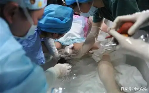 "水中分娩"真的比较不疼吗?看完图解后,网友:要是我我也选